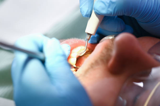 Best Emergency Dental Extractions in Stilwell, OK