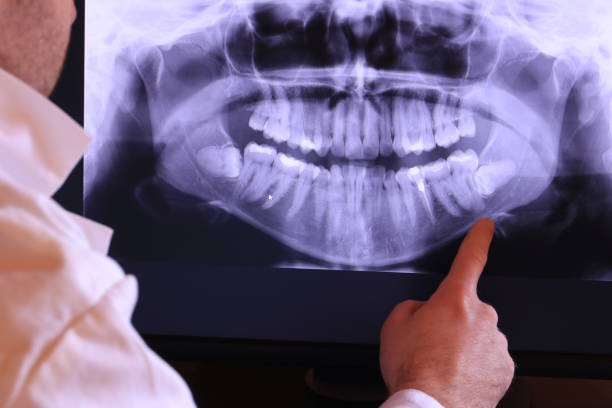 Best Emergency Dental Extractions in Stilwell, OK