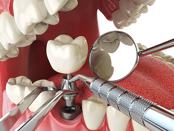 Best Weekend Emergency Dentist in Stilwell, OK