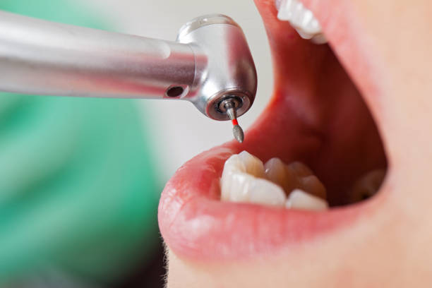 Best Mobile Emergency Dentist in Stilwell, OK